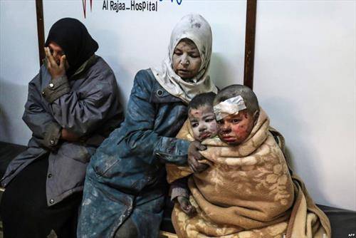 сириски деца повредени во бомбардирање во Дамаск