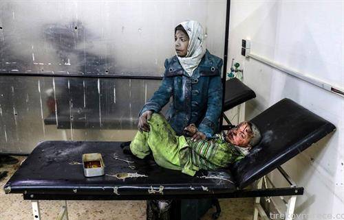 сириски деца повредени во бомбардирање во Дамаск